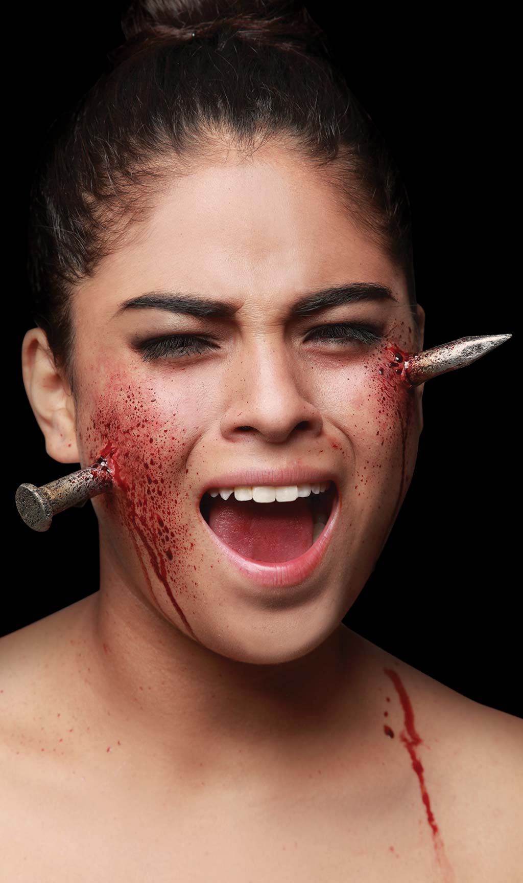 Herida de Clavo de látex