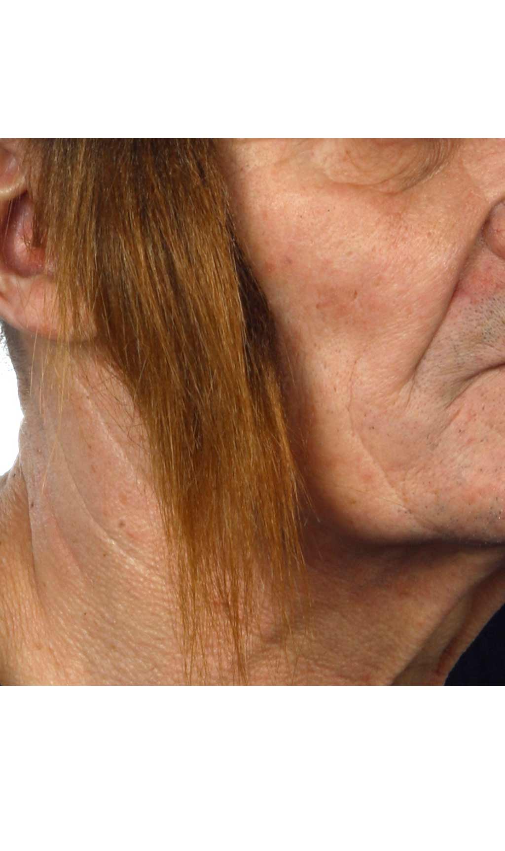 Patillas Castañas Profesional 028-LA