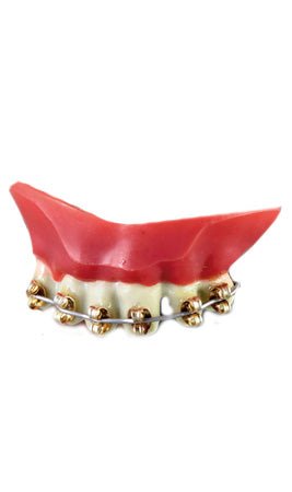 Dentadura de Hierro