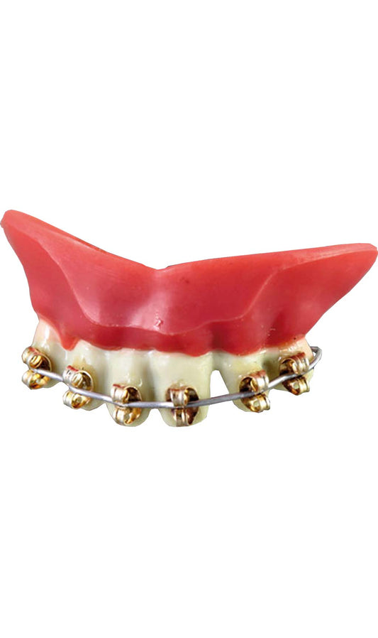 Dentadura de Hierro